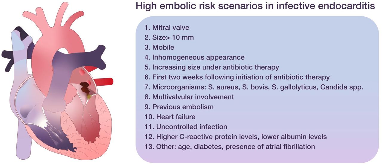 Embolic Risk Management In Infective Endocarditis Predicting The Embolic Roulette Open Heart Embolic Risk Management In Infective Endocarditis Predicting The Embolic Roulette Open Heart